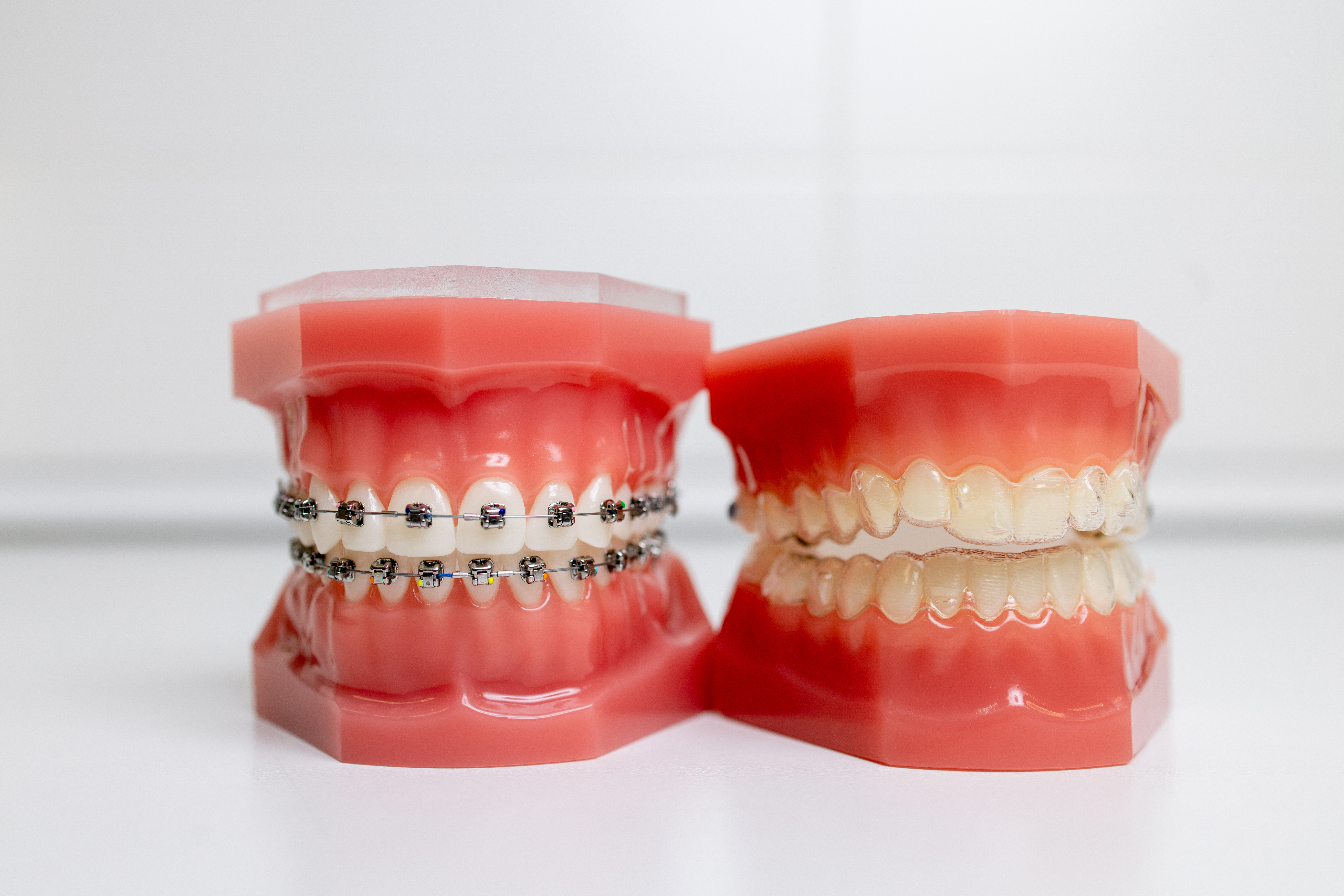 How to Choose the Right Orthodontic Treatment for Your Lifestyle